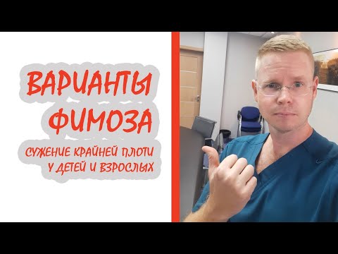 Варианты фимоза (сужение крайней плоти у детей и взрослых) / Доктор Черепанов