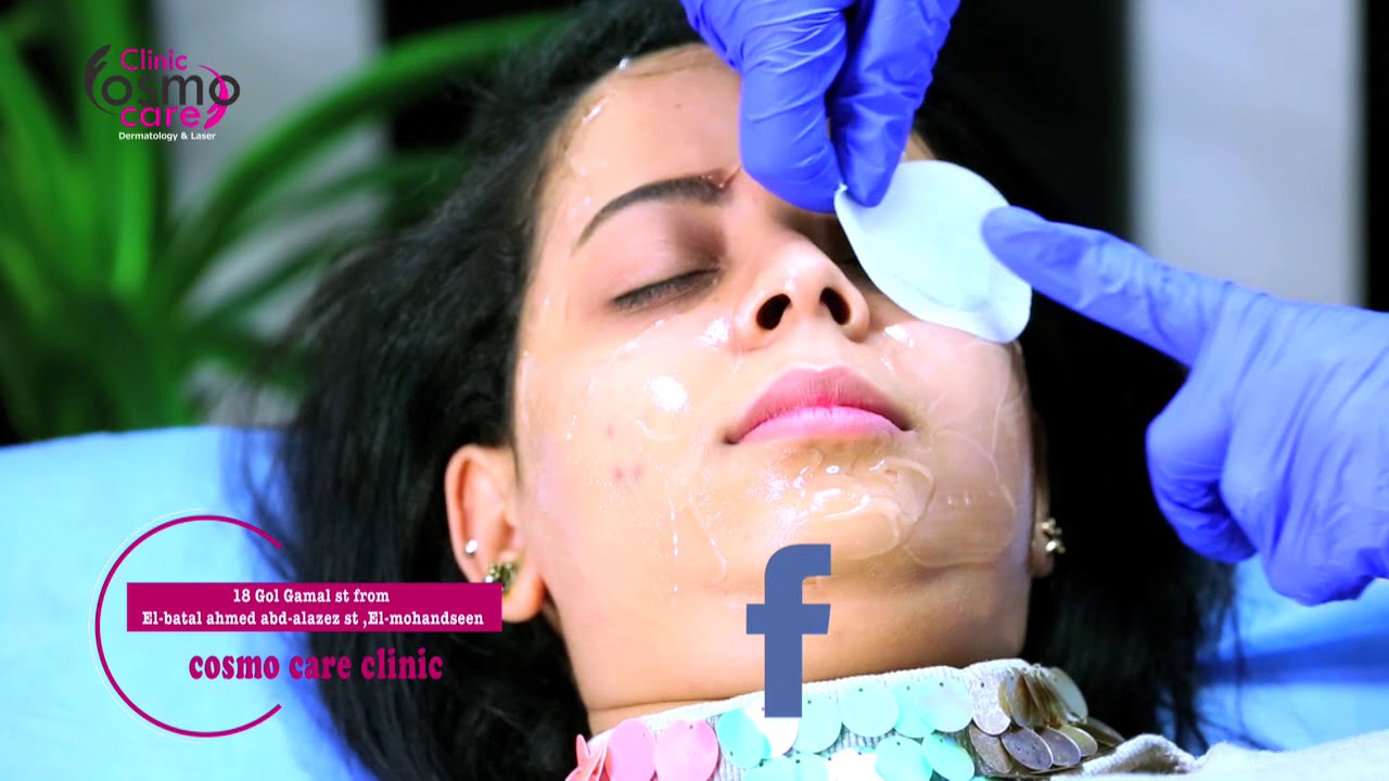 تنظيف البشرة بالليزر