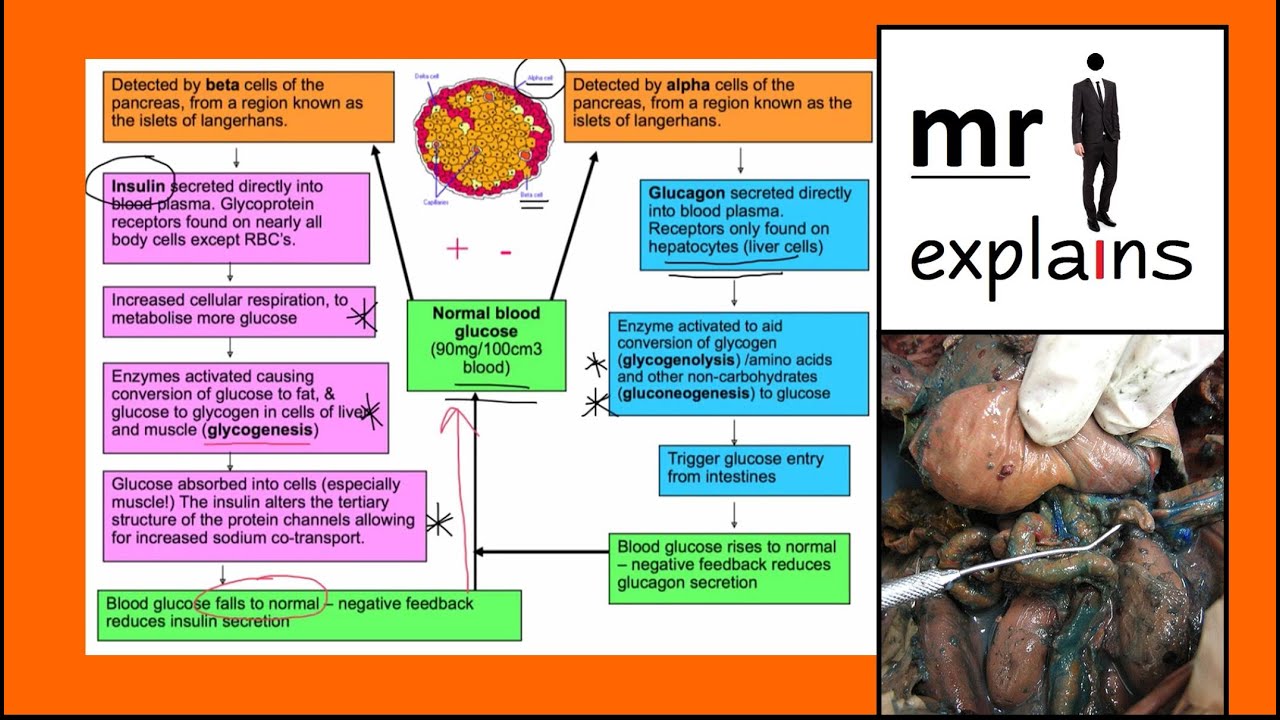 mr i explains Blood Glucose control and Diabetes, as part