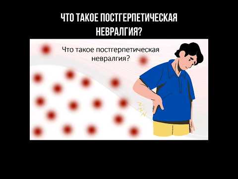 Что такое постгерпетическая невралгия? #герпес #невралгия #зуд #болитспина