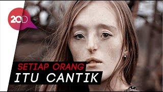 Download Lagu Foto-Foto Indah Wanita yang Terlahir Dengan Bibir Sumbing MP3