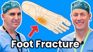 Jones and Fifth Metatarsal Fractures. How To Treat Your Broken Foot