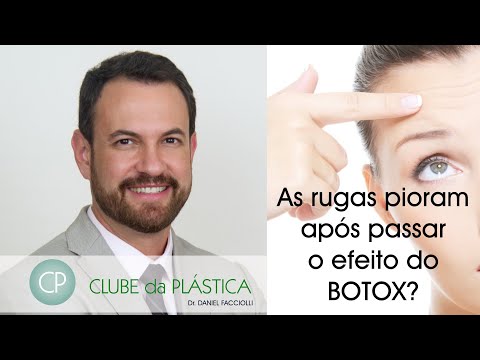 Vídeo: Quanto Mais Cedo Você Começa A Injetar, Mais Você Precisa: Victoria Bonya Falou Sobre Botox E Assimetria Facial