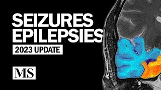 Seizures and Epilepsies (2023) by The Neurophile (by Rutgers RWJMS Neurology) 35,951 views 9 months ago 1 hour, 30 minutes