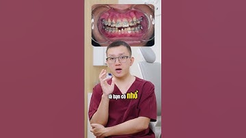 Làm răng sứ có niềng được không? #bsck1buihonghiep #niengrang