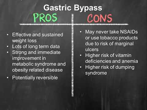 Types of Weight Loss Surgery | OSF Saint Francis Medical Center