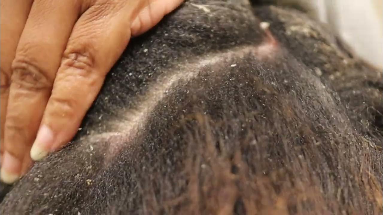 It's Been a While since this Scalp's been Scratched!!!Part 1 YouTube