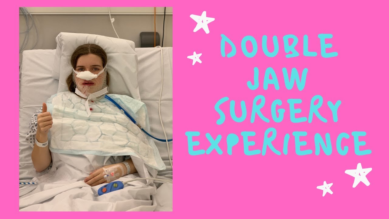 DOUBLE JAW SURGERY EXPERIENCE UK YouTube