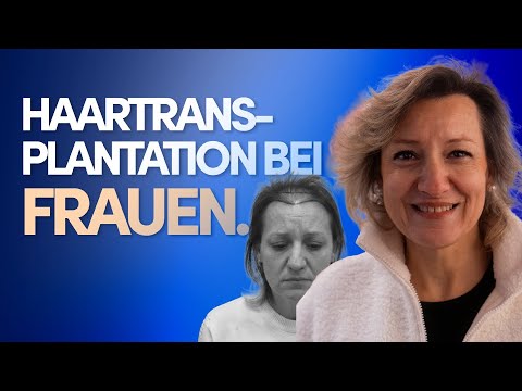 Hair transplantation for women: Back to joie de vivre at 47 | Elithair #ElitNewYear