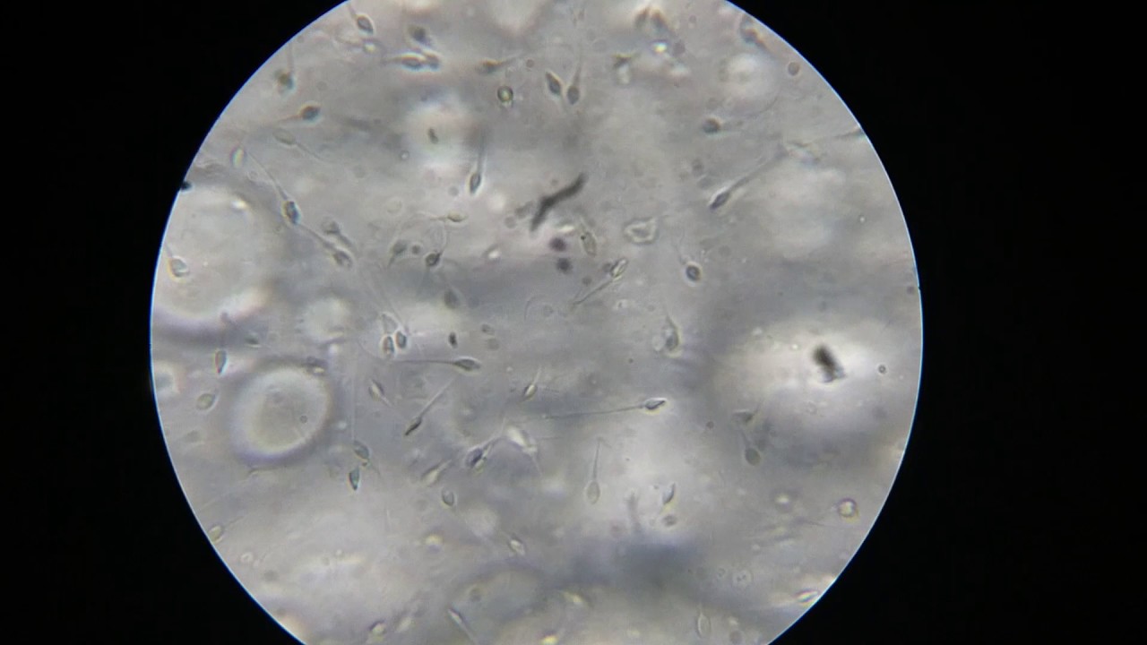 精子向上評価していくための指標を決めてみる