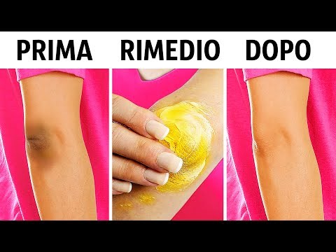 10 Trucchi naturali per rimuovere macchie scure da ginocchia e gomiti