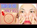 MELT BLACKHEADS WITH OIL?!?! i mean i guess...