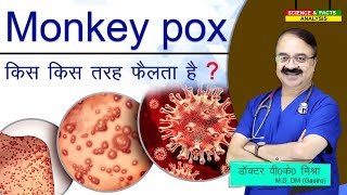 Monkey pox किस किस तरह फैलता है ? || MONKEY POX VIRUS FOR YOUR AWARENESS HOW IS IT TRANSMITTED