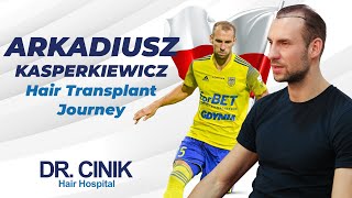 Arkadiusz Kasperkiewicz | Hair Transplant | Dr. Emrah Cinik