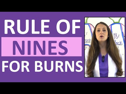 Video: Rule Of Nines: Burns, Children, Adults, Wallace En Meer