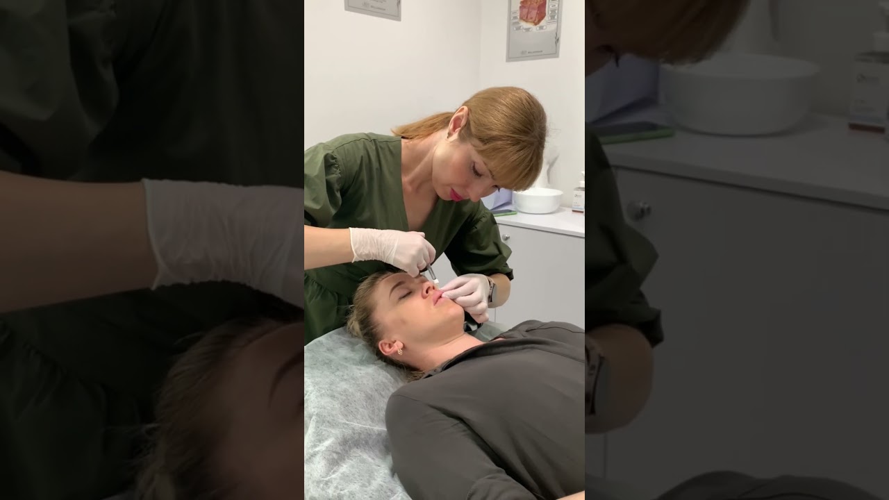 Прев'ю відео: Процес аугментації губ