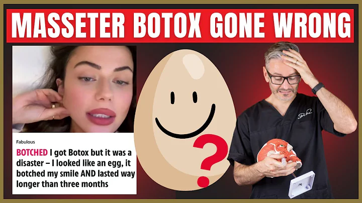 Evita questo errore con il Botox | Consigli degli esperti prima dell'iniezione nei muscoli masseteri