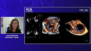 Echocardiographic imaging for transcatheter tricuspid intervention - Webinar screenshot 3