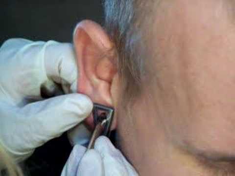 What gauge is normal ear piercing?