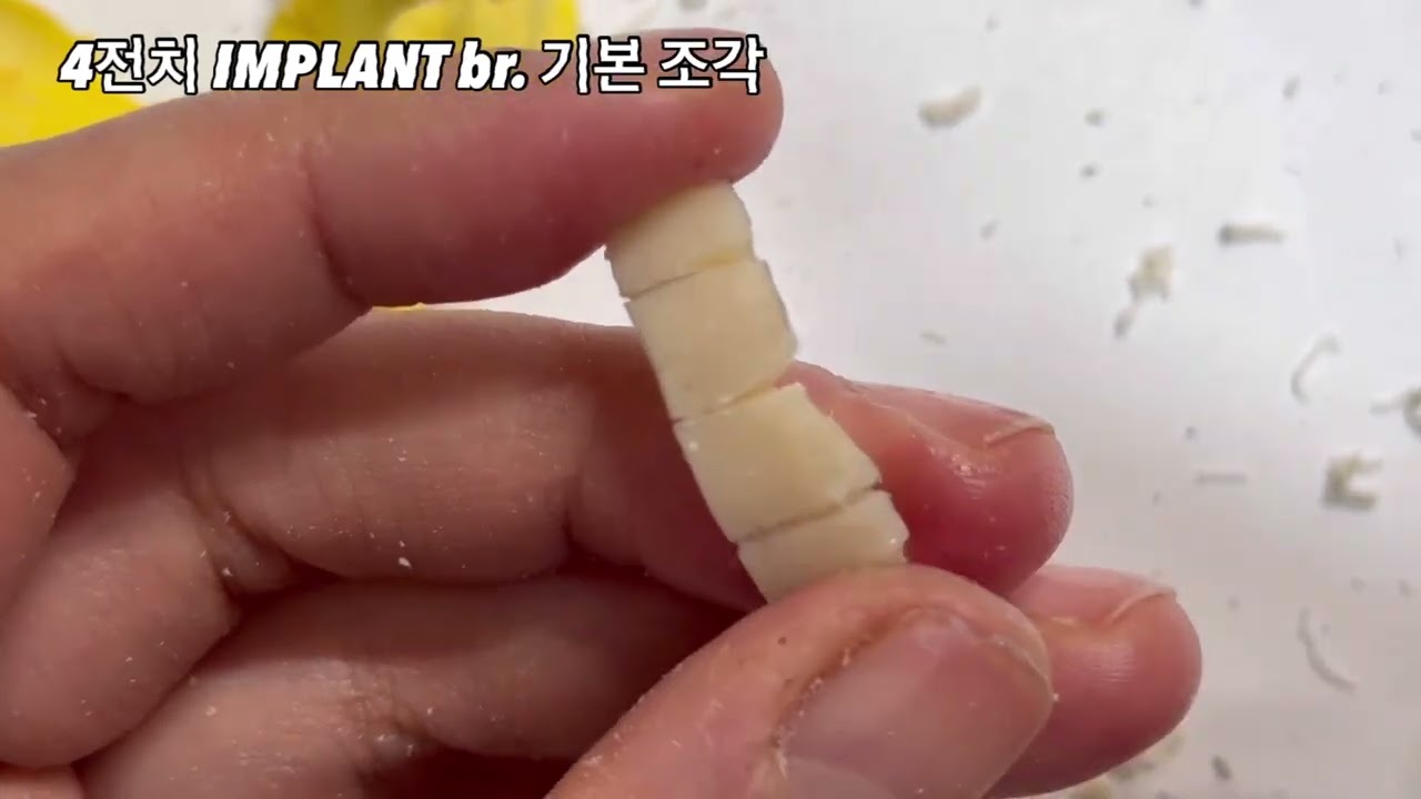 4전치 임플란트 bridge 기본 형태 조각
