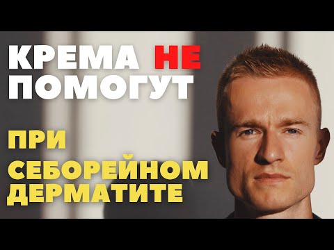 Как лечить себорейный дерматит без кремов (тридерм, акридерм, элокон, белосалик, низорал, цинокап)