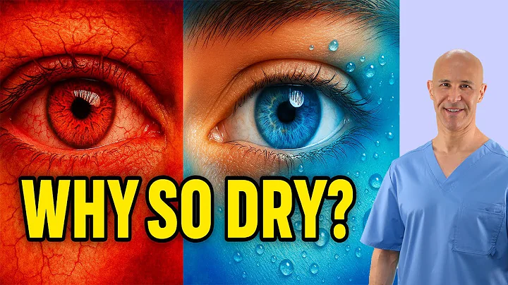 Dry Eyes That Won’t Go Away? THIS Finally Fixed It — Here’s Why Nothing Else Worked |  Dr. Mandell