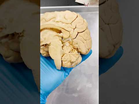 The Best Part of Your Brain