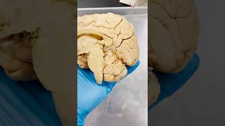 The Best Part of Your Brain