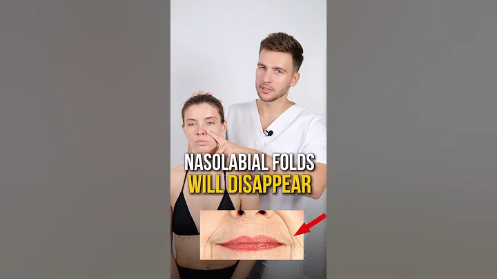 Removing nasolabial folds🔥 #wrinkles #lifting #facelift #antiaging #faceyoga #health