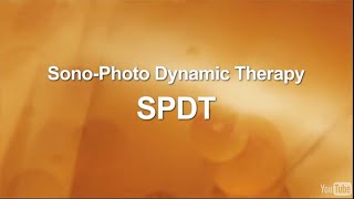 SonoDynamic Therapy for Cancer Treatment