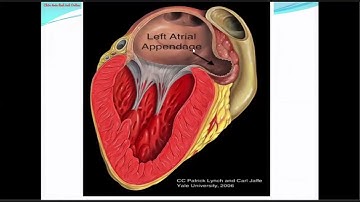 Bài 20: Siêu âm tim - Hẹp van hai lá  | TS.BS Tạ Thị Thanh Hương