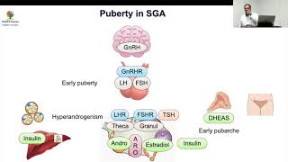 iSGA Pubertal Issues