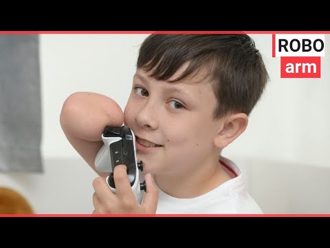 Schoolboy who plays Xbox with chin has been given a bionic arm | SWNS TV