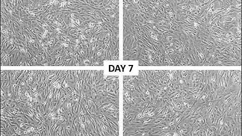 Time-Lapse Micrograph of the Last 24hr of Branching and Maturation of hPSC-derived 3D Lung Organoids