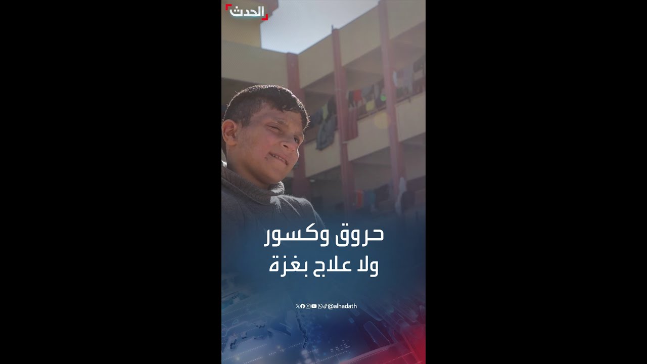 مأساة الطفل أحمد.. مصاب بالحروق والكسور ولا يقوى على المشي في غزة