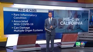 Cases of rare MIS-C condition for kids have tripled in California since February