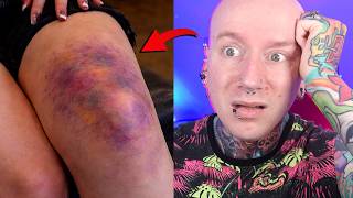 Tattooing Wounds Is A TERRIBLE Idea