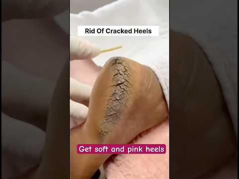 Worlds best pedicure