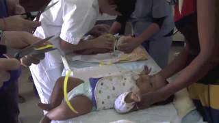 NMT Tutorial Volunteer Training Mekelle Pediatric Club Foot N° 8 screenshot 2
