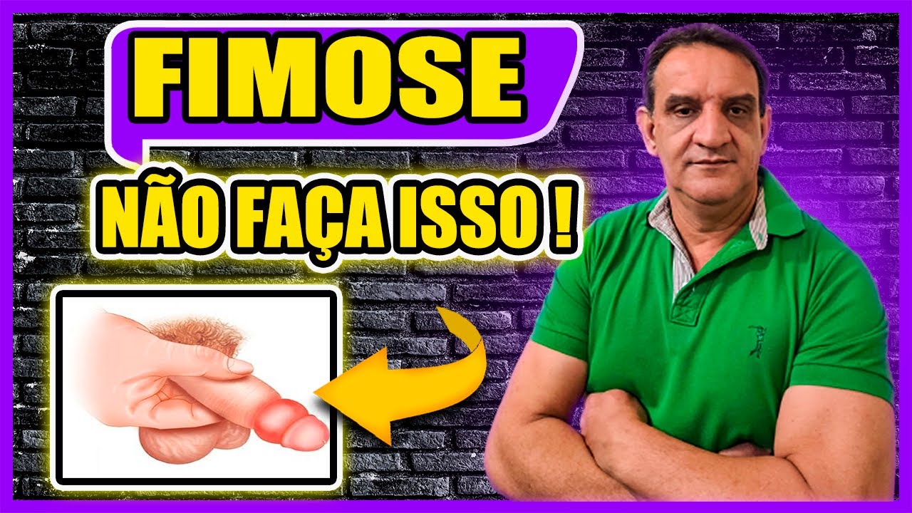 😮👉CUIDADO NÃO FAÇA ISSO SE VOCÊ TEM FIMOSE ! COMO TIRAR A FIMOSE EM ...