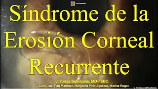 Síndrome de la Erosión Corneal Recurrente.
