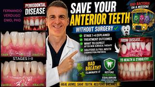 Severe Gum Disease: Save Your Teeth, Fix Bad Breath & Protect Your Heart | Periodontist Explains
