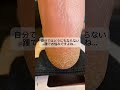 自分ではどうにもならない踵でお悩みですよね...