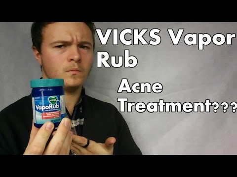 Video: Vicks Voor Acne: Werkt Het?