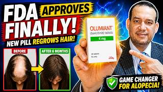 Alopecia Areata Treatment Finally Explained (Olumiant / Baricitinib)