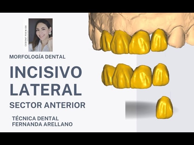 Anatomía Dental Del Incisivo Central Maxilar