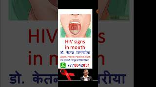 hiv signs in mouth | hiv mouth ulcer | hiv mouth symptoms | hiv mouth | hiv mouth infection  #shorts