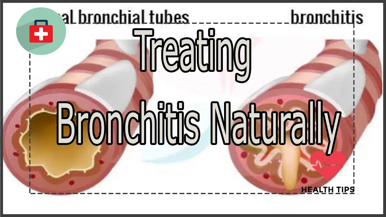Treating Bronchitis Naturally | Health Today 