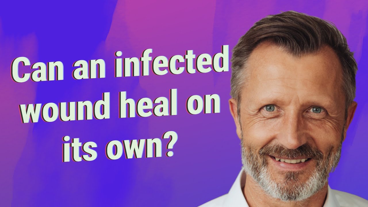 Can An Infected Wound Heal On Its Own YouTube Can an infected wound heal on its own youtube