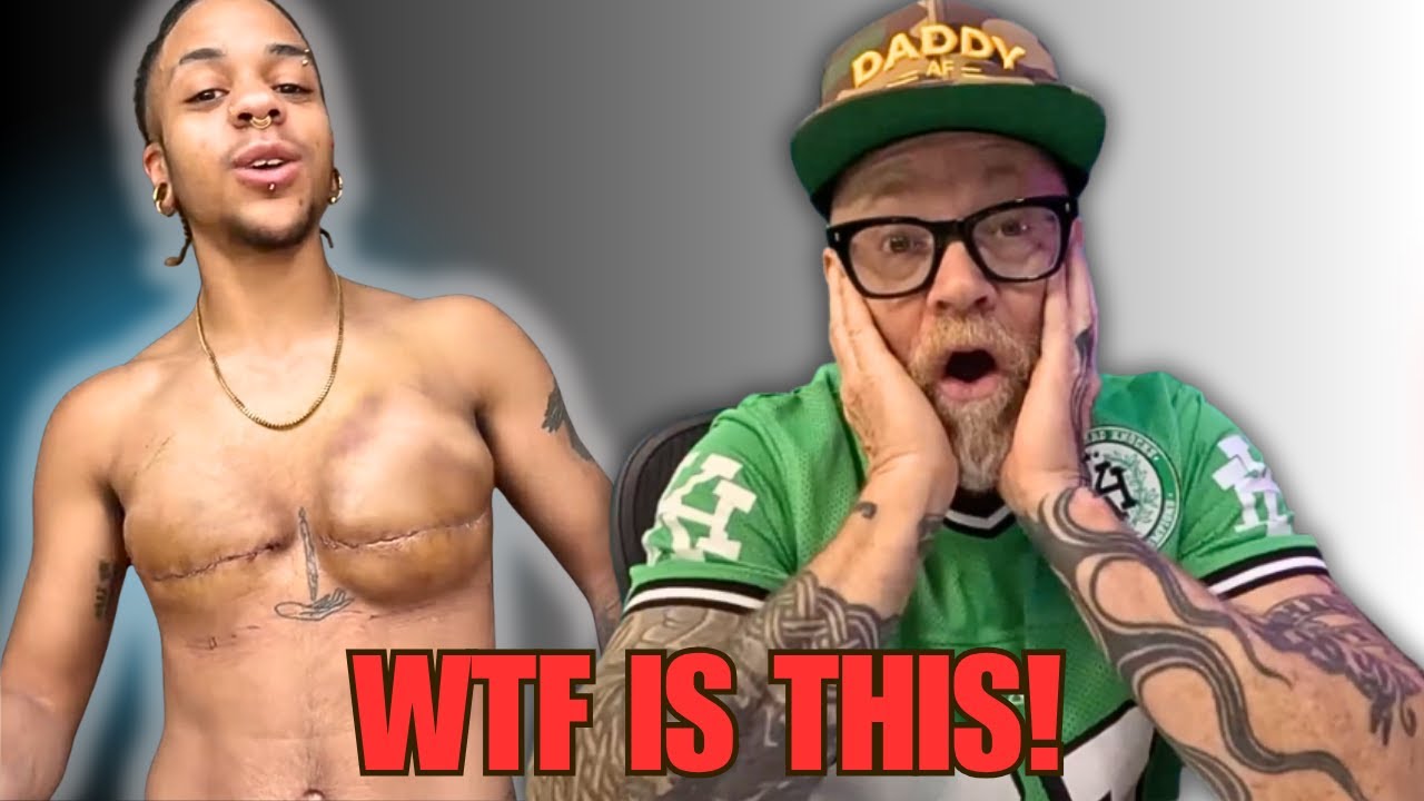 «Дерьмо случается». Эксперимент со шрамом на трансгендере.